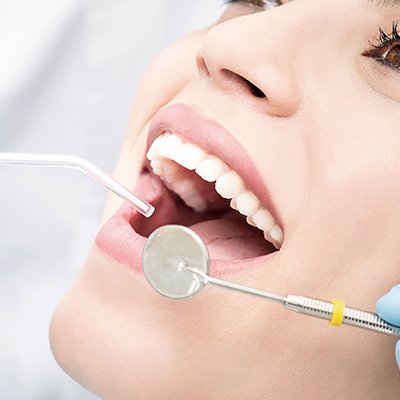 Cosmetic dentistry in Karnataka