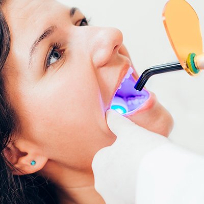 Dental checkup in Bangalore