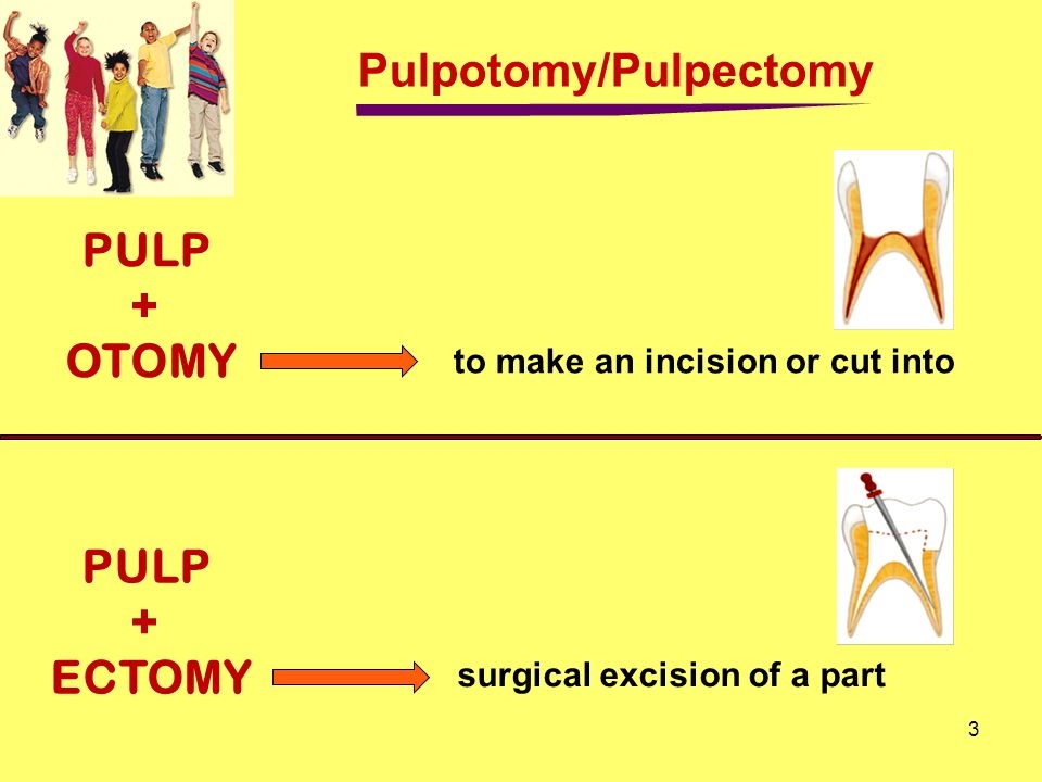 pulpectomy-and-pulpotomy