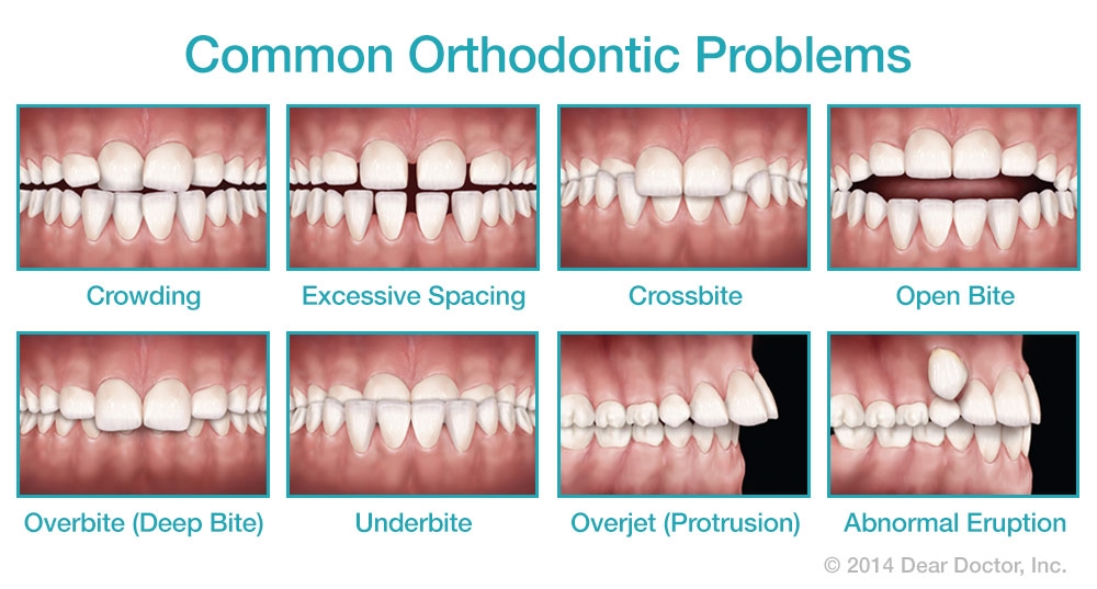 orthodontics