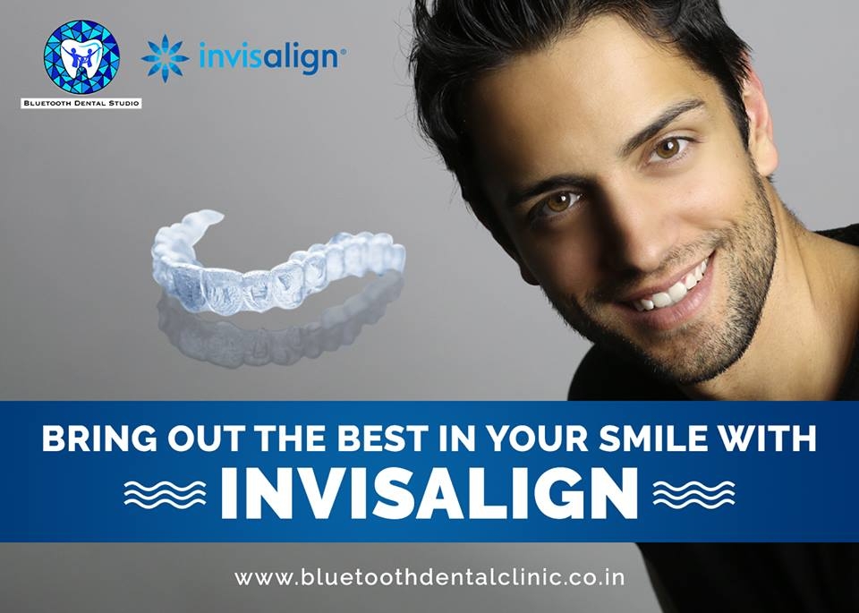 invisalign